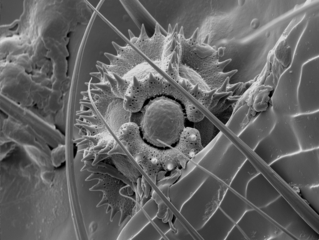 Tip of fly foot (Environmental Scanning Electron Microscope)